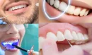 Düzce Diş Beyazlatma Nedir ve Neden Tercih Edilir?