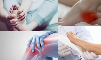 Düz Tabanlık Nedir?