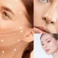 What is the Difference Between Deep Plane Facelift and Classic Facelift?
